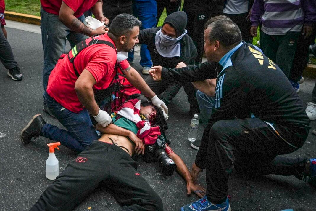 Fotógrafo Pablo Grillo, herido en la cabeza durante protestas en el Congreso. Fotógrafo Pablo Grillo, herido en la cabeza durante protestas en el Congreso.